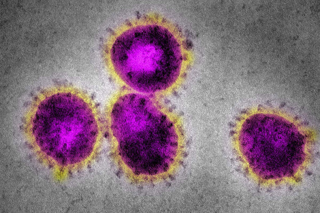 Scott Camazine از آژانس عکس Alamy. عکس میکروسکپی از ویروس کرونا که منجر به سندرم حاد تنفسی (مخفف: سارس) می‌شود. 